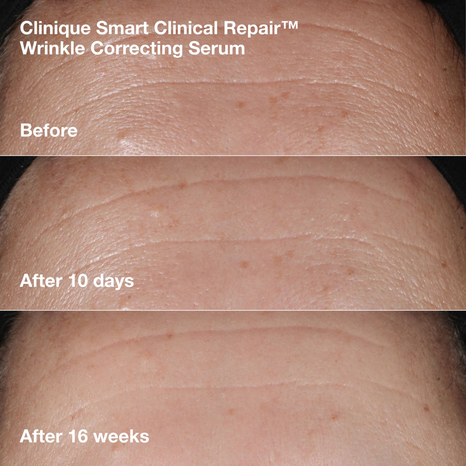Wrinkle Correcting Routine