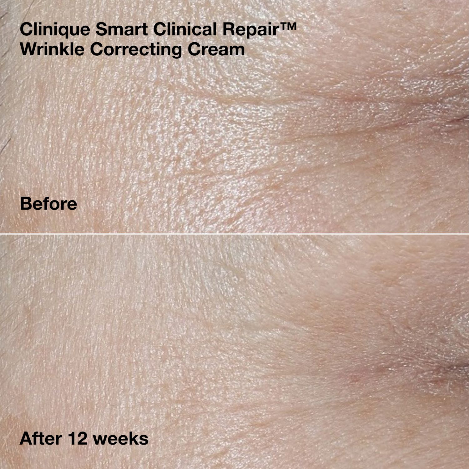 Wrinkle Correcting Routine